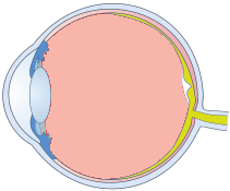 Vitreous Support